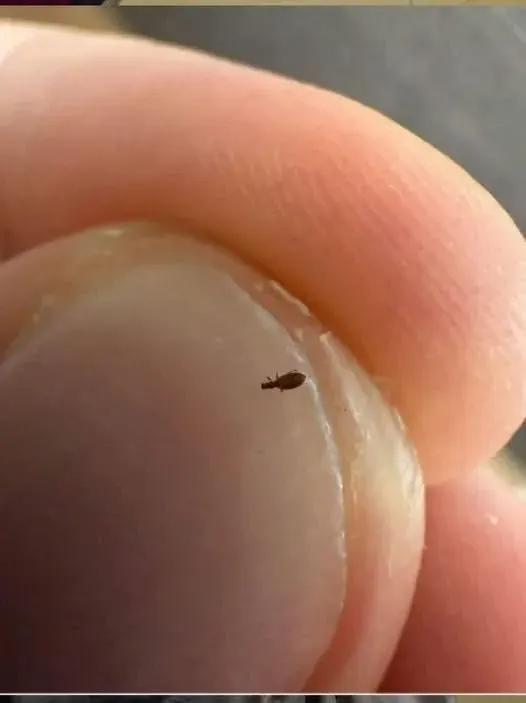 Original post image accompanying Bug Found in My Friend's Hair: What It Could Be